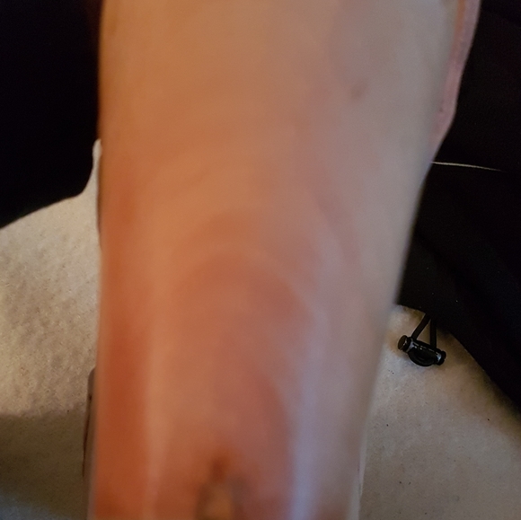 Clog sandals - Picture 4 of 5